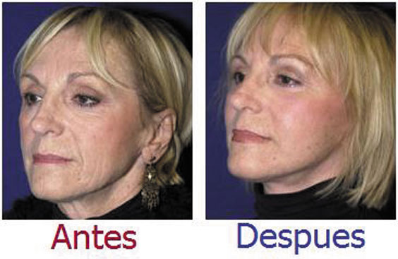 serum-rostro-3